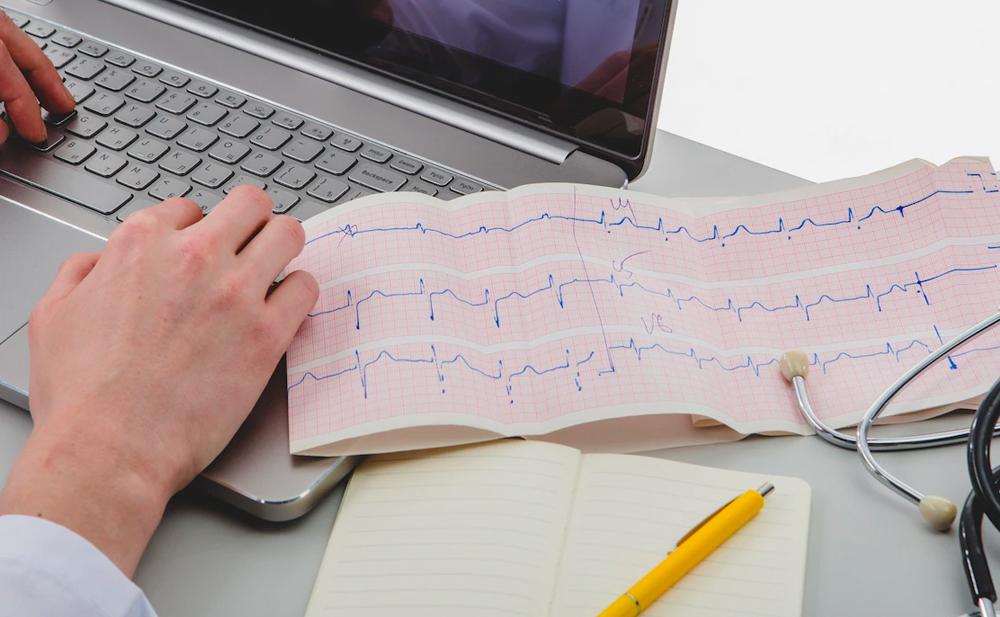 ELECTROCARDIOGRAMA